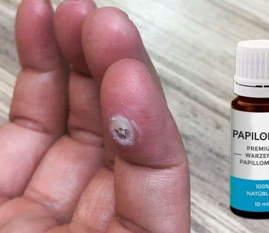 Papilomol im Expertencheck ᐅ Eine kritische Betrachtung… papilomol