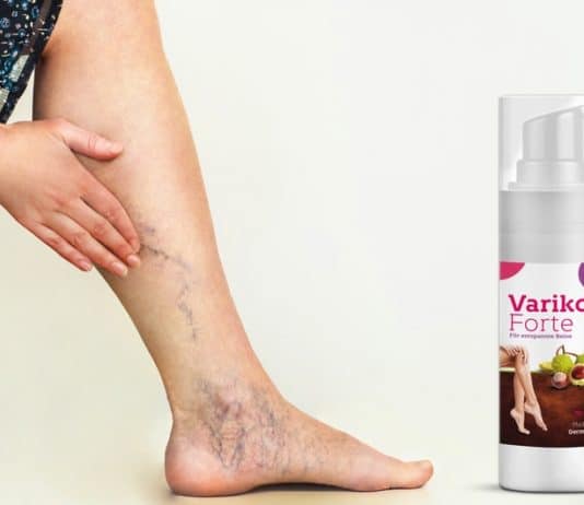 Variko Forte im Expertencheck ᐅ Eine kritische Betrachtung… variko forte